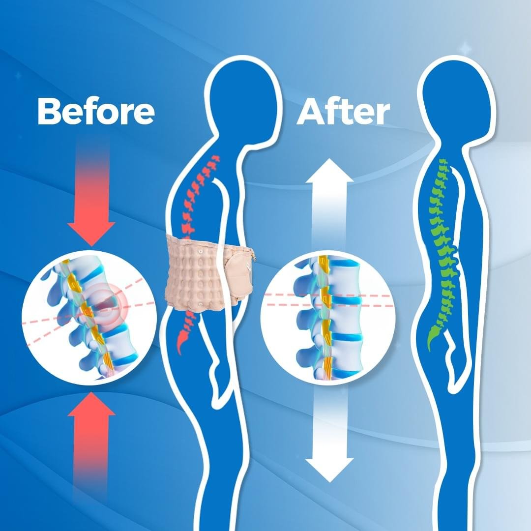 Ryggbälte™ - Ditt ryggstöd mot smärta