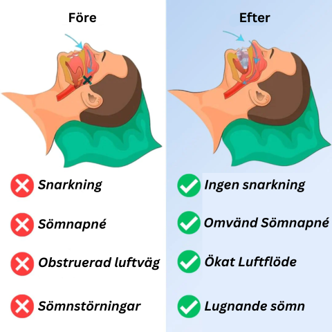 QuietSleep™ - Munstycke Mot Snarkning